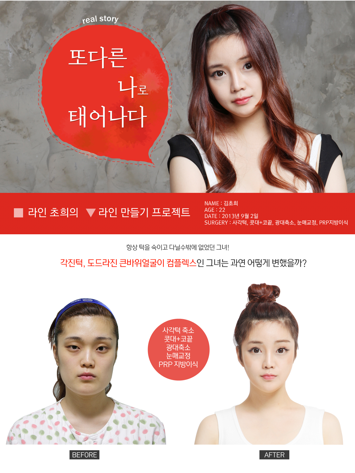 초희의 리얼스토리[v라인만들기 프로젝트]
