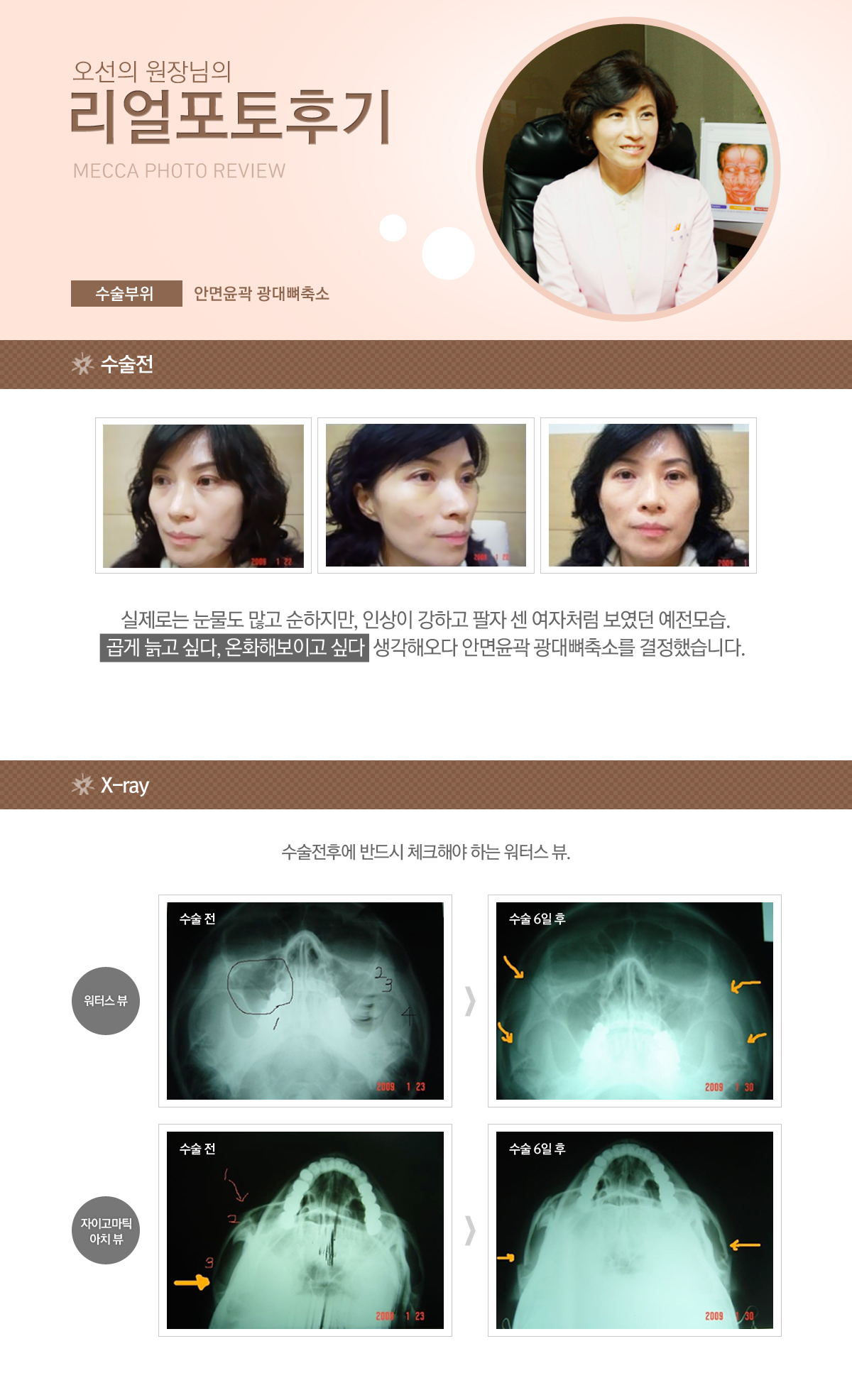 오선의 원장님의 리얼 포토후기