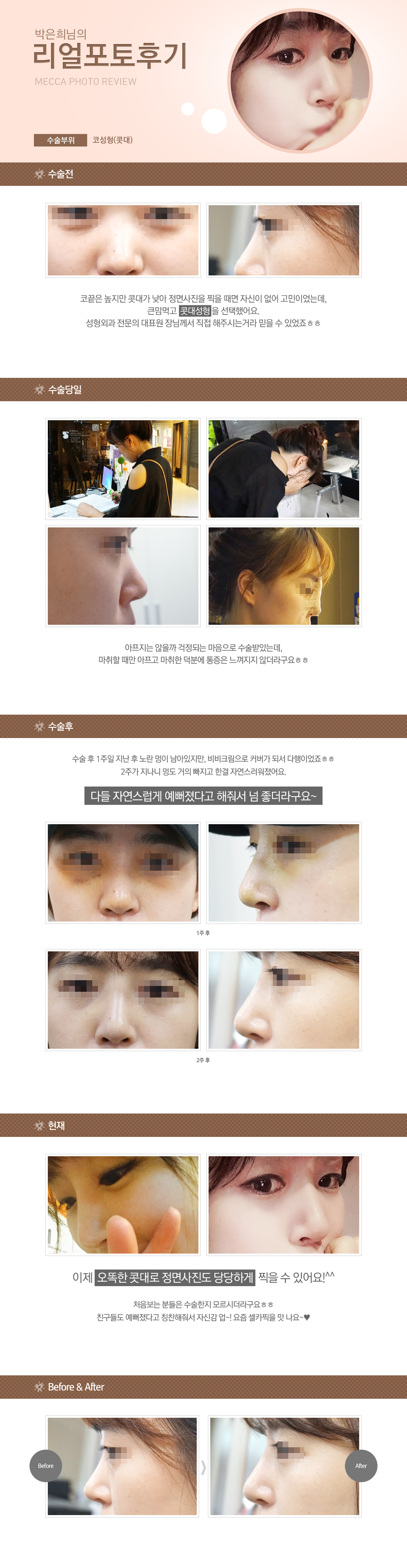 박은희님의 리얼 포토후기