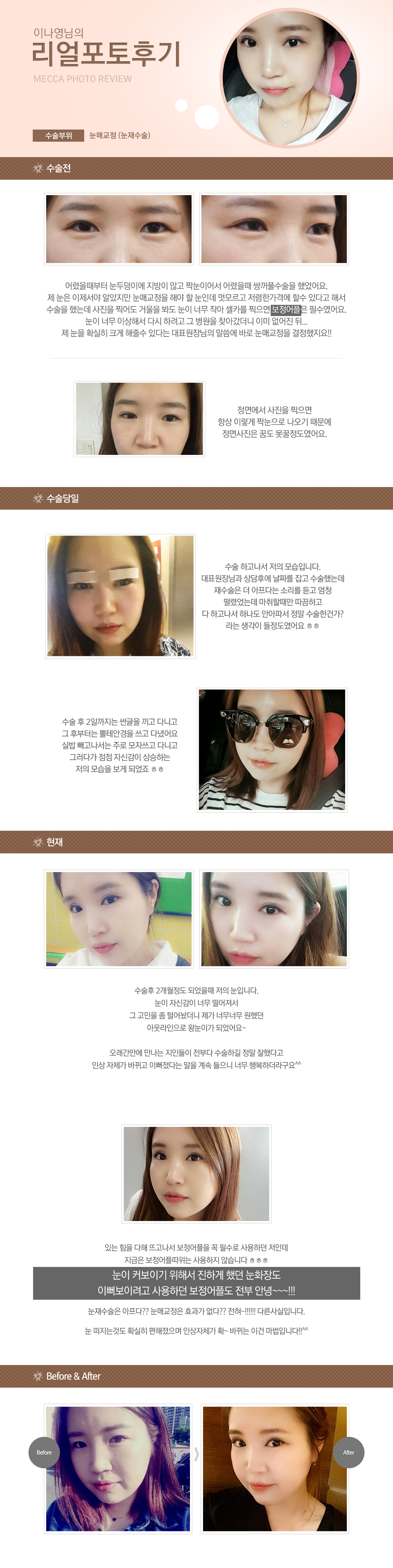 이나영님의 리얼 포토후기