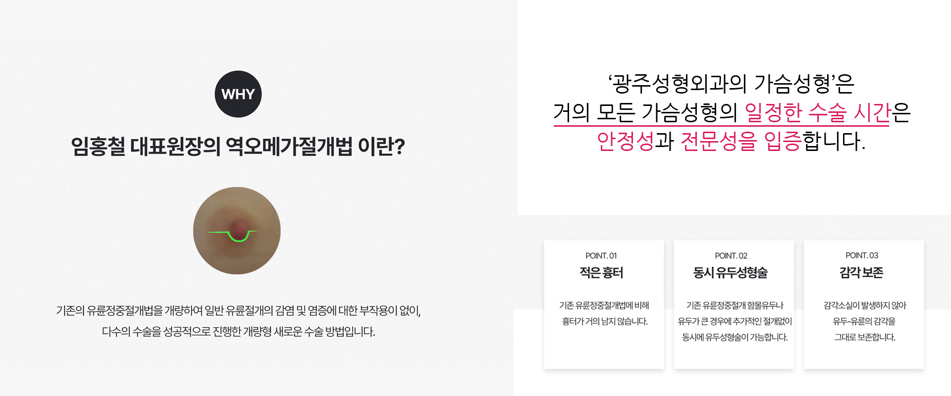 가슴성형